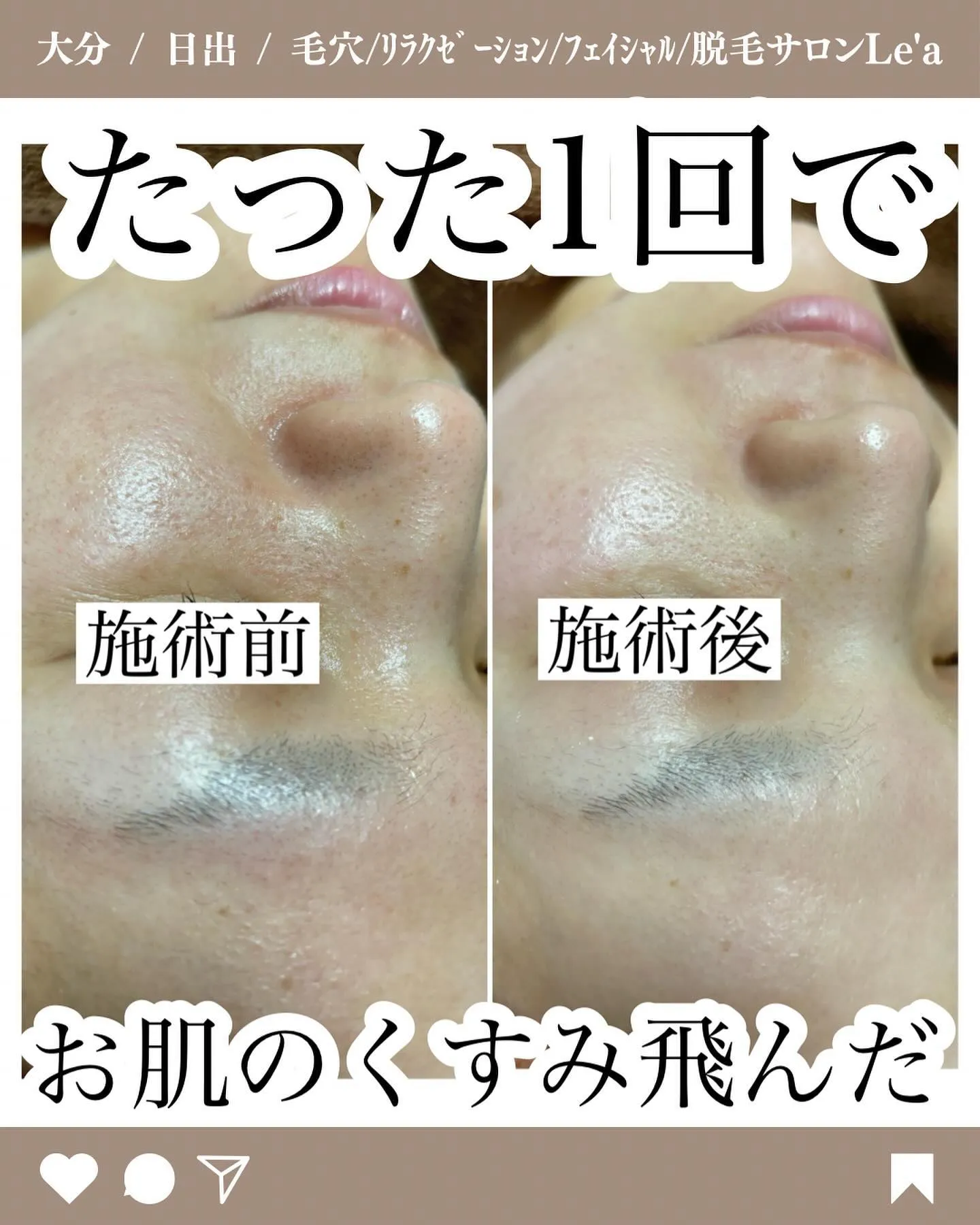 【白玉WAXで化粧水の浸透率アップ】